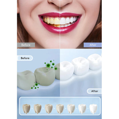 Kit LED Blanqueador Dental Portátil